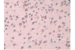 IHC-P analysis of Mouse Brain Tissue, with DAB staining. (TPP1 anticorps  (AA 198-562))