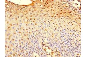 Immunohistochemistry of paraffin-embedded human tonsil tissue using ABIN7173626 at dilution of 1:100 (TSC22D3 anticorps  (AA 58-134))