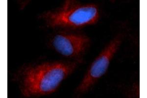 Immunofluorescence (IF) image for anti-Keratin 8 (KRT8) (AA 1-483) antibody (PE) (ABIN5567068) (KRT8 anticorps  (AA 1-483) (PE))
