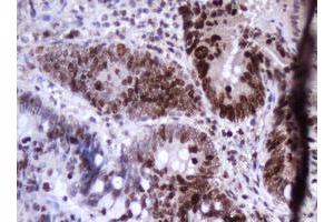 Image no. 3 for anti-Antigen Identified By Monoclonal Antibody Ki-67 (MKI67) (AA 2924-3256) antibody (ABIN1491345)