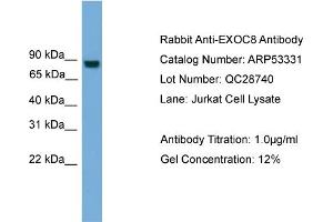 WB Suggested Anti-EXOC8  Antibody Titration: 0. (EXOC8 anticorps  (N-Term))