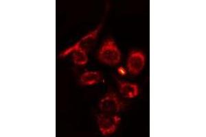 ABIN6275689 staining HT29 cells by IF/ICC. (ZFYVE19 anticorps  (Internal Region))