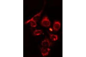 ABIN6275689 staining HT29 cells by IF/ICC. (ZFYVE19 anticorps  (Internal Region))