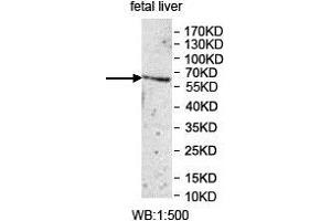Western blot analysis of fetal liver lysate, using UGT1A1 antibody. (UGT1A1 anticorps  (AA 26-193))