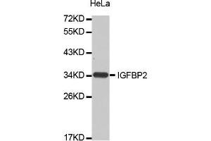 Western Blotting (WB) image for anti-Insulin-Like Growth Factor Binding Protein 2, 36kDa (IGFBP2) (AA 100-200) antibody (ABIN5663646) (IGFBP2 anticorps  (AA 100-200))
