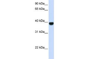 WB Suggested Anti-FOXE1 Antibody Titration: 0. (FOXE1 anticorps  (Middle Region))