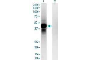 Western Blot analysis of OTP expression in transfected 293T cell line by OTP monoclonal antibody (M03), clone 8E12.