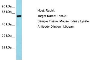 Host: Rabbit Target Name: Trim35 Sample Type: Mouse Kidney lysates Antibody Dilution: 1. (TRIM35 anticorps  (Middle Region))