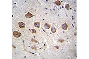 KCNRG antibody analysis in formalin fixed and paraffin embedded human brain tissue.