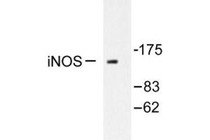 Image no. 1 for anti-Nitric Oxide Synthase 2, Inducible (NOS2) antibody (ABIN265479) (NOS2 anticorps)