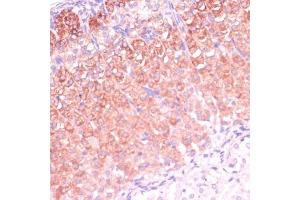 Immunohistochemistry of paraffin-embedded mouse adrenal gland using CYP11B2 antibody (ABIN1679468, ABIN3015492, ABIN3015493 and ABIN6218533) at dilution of 1:100 (40x lens). (CYP11B2 anticorps  (AA 234-503))
