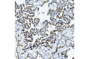 Immunohistochemistry of paraffin-embedded rat lung using  Rabbit pAb (ABIN3016739, ABIN3016740, ABIN3016741, ABIN1678526 and ABIN6219830) at dilution of 1:100 (40x lens). (Angiotensin I Converting Enzyme 1 anticorps  (AA 30-270))