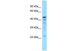 WB Suggested Anti-NT5C Antibody Titration: 1. (NT5C anticorps  (C-Term))