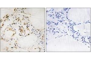 Immunohistochemistry analysis of paraffin-embedded human thyroid gland, using BCL-2 (Phospho-Ser87) Antibody.