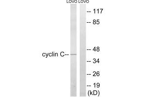Western blot analysis of extracts from LOVO cells, using Cyclin C (epitope around residue 275) antibody. (Cyclin C anticorps  (Ser275))
