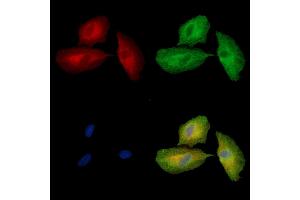 ABIN7095036 and ABIN7099092 staining  cells by IF/ICC.