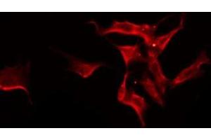 ABIN6275588 staining Hela by IF/ICC. (SLC24A3 anticorps  (Internal Region))