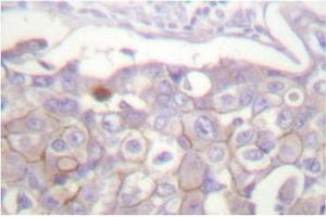 Image no. 1 for anti-Claudin 4 (CLDN4) antibody (ABIN265363) (Claudin 4 anticorps)