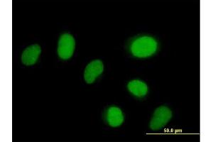 Immunofluorescence of purified MaxPab antibody to ZNF792 on HeLa cell. (ZNF792 anticorps  (AA 1-553))