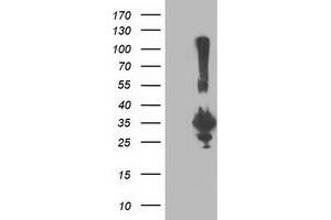 Western Blotting (WB) image for anti-Phenylethanolamine N-Methyltransferase (PNMT) antibody (ABIN1500311) (PNMT anticorps)