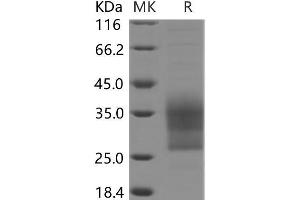 Western Blotting (WB) image for CD79b Molecule, Immunoglobulin-Associated beta (CD79B) protein (His tag) (ABIN7320157)