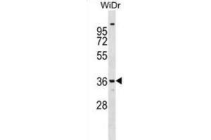 Western Blotting (WB) image for anti-Annexin A9 (ANXA9) antibody (ABIN2999180) (Annexin A9 anticorps)