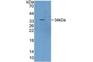 Detection of Recombinant FRAP, Human using Polyclonal Antibody to Serine/threonine-protein kinase mTOR (mTOR) (MTOR anticorps  (AA 2226-2488))