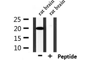 Western blot analysis of extracts from rat brain, using KAD6 Antibody.