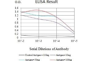 Black line: Control Antigen (100 ng),Purple line: Antigen (10 ng), Blue line: Antigen (50 ng), Red line:Antigen (100 ng)