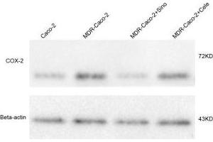 COX-2 over expressed in MDR-Caco-2 cells, which could be reversed by sinomenine.