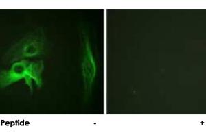 Immunofluorescence analysis of HeLa cells, using PAK1 polyclonal antibody . (PAK1 anticorps)
