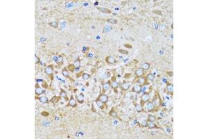 Immunohistochemistry of paraffin-embedded mouse brain using ACTR2 antibody. (ACTR2 anticorps  (AA 1-160))