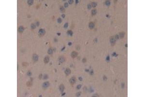 Used in DAB staining on fromalin fixed paraffin- embedded Kidney tissue
