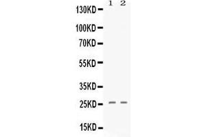 Western blot analysis of PF4 expression in 293T whole cell lysates ( Lane 1) and A549 whole cell lysates ( Lane 2). (PF4 anticorps  (AA 32-101))