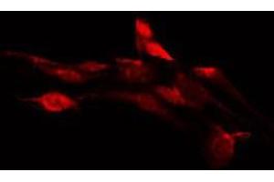 ABIN6276123 staining HepG2 by IF/ICC. (OR1D2 anticorps  (Internal Region))