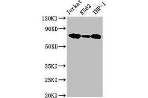Western Blot Positive WB detected in: Jurkat whole cell lysate, K562 whole cell lysate, THP-1 whole cell lysate All lanes: LCP1 antibody at 2. (LCP1 anticorps  (AA 2-627))