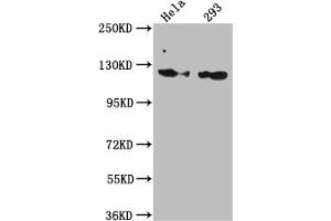 Western Blot Positive WB detected in: Hela whole cell lysate, 293 whole cell lysate All lanes: RNF20 antibody at 1:1000 Secondary Goat polyclonal to rabbit IgG at 1/50000 dilution Predicted band size: 114 kDa Observed band size: 114 kDa