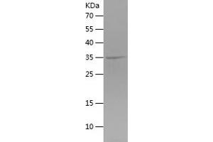 Western Blotting (WB) image for TBC1 Domain Family, Member 5 (TBC1D5) (AA 496-795) protein (His tag) (ABIN7125331)
