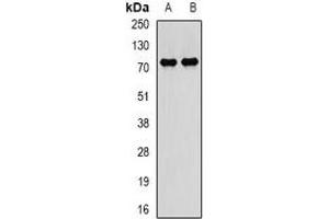 Western blot analysis of PADI4 expression in BT474 (A), SKOV3 (B) whole cell lysates.