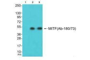 Western blot analysis of extracts from HepG2 cells (Lane 2) and 3T3 cells (Lane 3), using MITF (Ab-180/73) antiobdy. (MITF anticorps  (Ser73, Ser180))