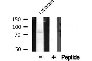 Western blot analysis of extracts from rat Brian, using CDH9 antibody. (Cadherin 9 anticorps  (Internal Region))