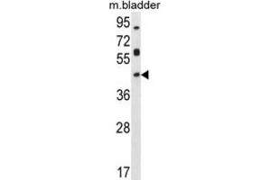 Western Blotting (WB) image for anti-Homeobox D13 (HOXD13) antibody (ABIN2996088)