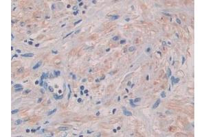 Detection of SEMA3A in Human Prostate Tissue using Polyclonal Antibody to Semaphorin 3A (SEMA3A)