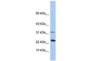 EXOSC3 antibody used at 1 ug/ml to detect target protein. (EXOSC3 anticorps  (C-Term))