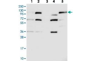 Western blot analysis of Lane 1: RT-4, Lane 2: U-251 MG, Lane 3: Human Plasma, Lane 4: Liver, Lane 5: Tonsil with FILIP1L polyclonal antibody .