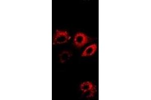 Immunofluorescent analysis of ALDH4A1 staining in A549 cells. (ALDH4A1 anticorps)