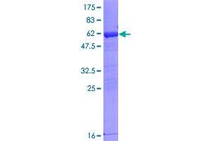 Image no. 1 for Gem (Nuclear Organelle) Associated Protein 2 (GEMIN2) (AA 1-280) protein (GST tag) (ABIN1320025)