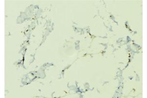 ABIN6276645 at 1/100 staining Human lung tissue by IHC-P.