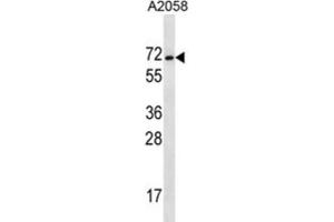 Western Blotting (WB) image for anti-Melanoma Antigen Family E, 2 (MAGEE2) antibody (ABIN2997193) (MAGEE2 anticorps)