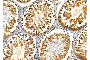 ABIN6257627 and ABIN6275371 at 1/100 staining Rat testis tissue by IHC-P.